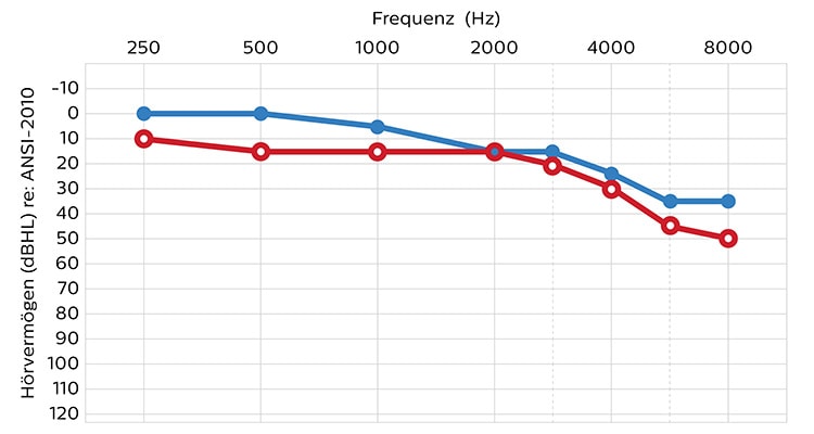 hearing_level_ansi-2010_01_de_750x400