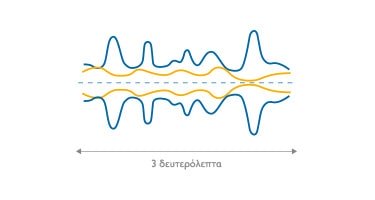 high_noise_level_gr_375x200