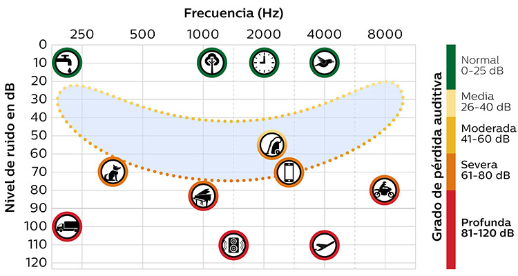 750x400_speech_chart_01_mx