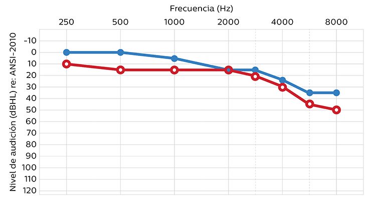 750x400_hearing_level_ansi-2010_mx
