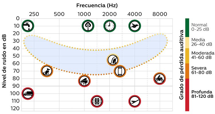 750x400_speech_chart_01_mx