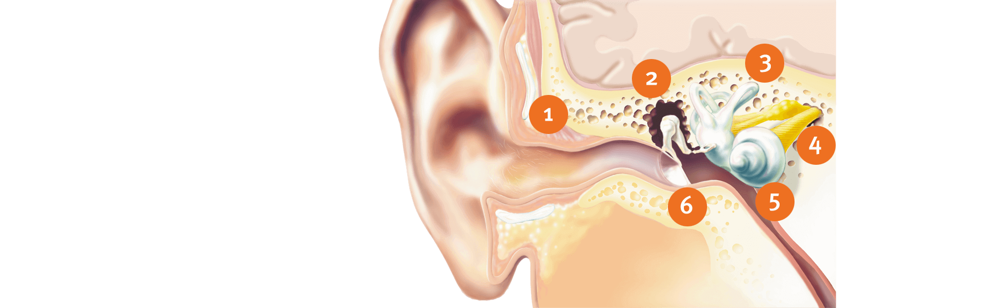 types of hearing loss