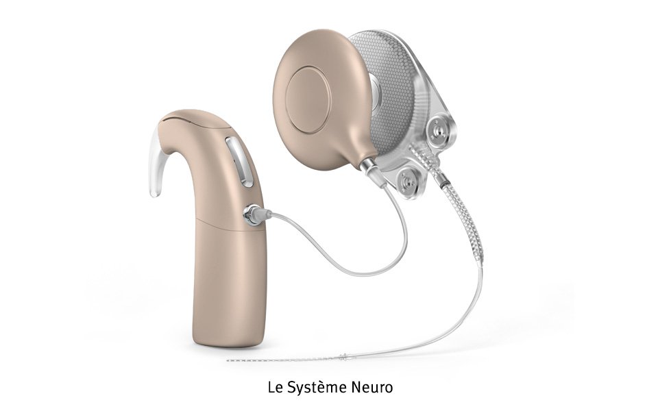The Neuro System opens up the world of sound