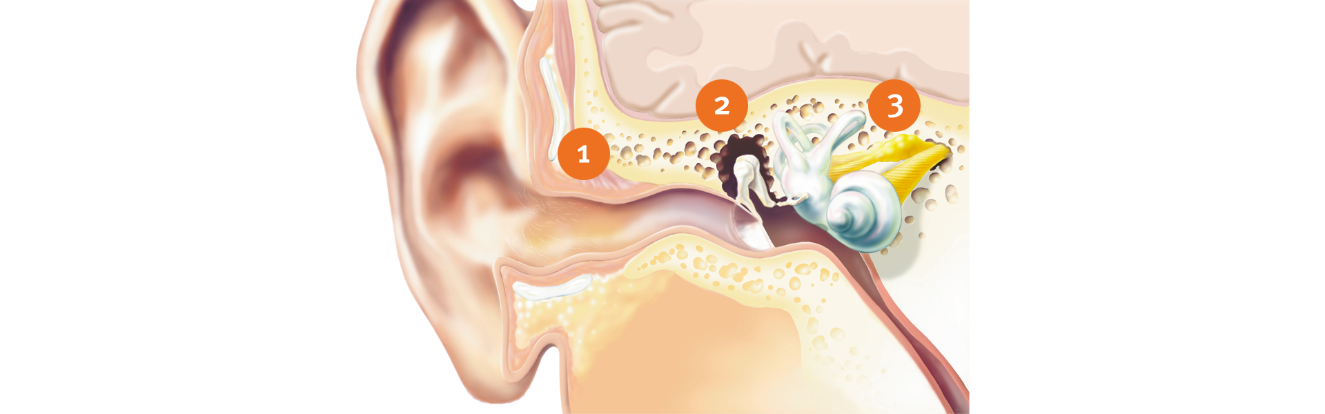 How hearing works