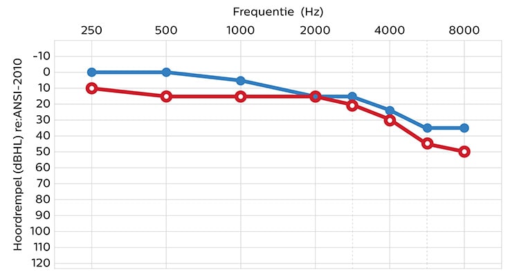 hearing_level_ansi-2010_nl_750_400