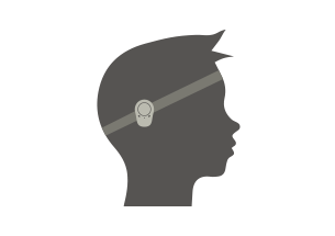 305x215-considering-an-implant-for-your-child