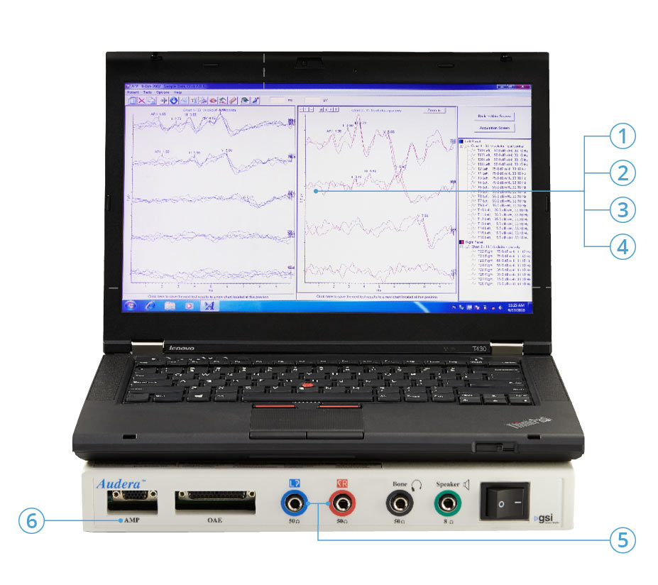 GSI Audera Evoked Potentials Features