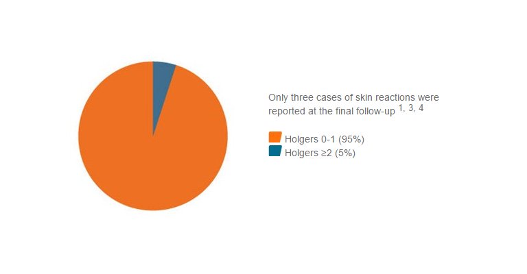 Only few complications with Ponto