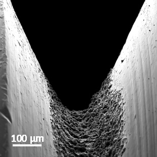 Macro implant - bone bonding