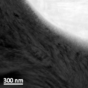 Mineralised bone - bone bonding